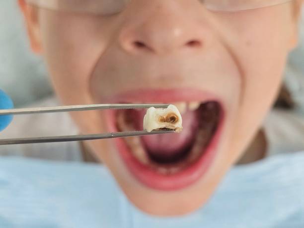 Best Emergency Dentist for Special Needs Patients in Hudson, TX