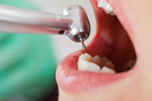 Best Broken or Cracked Tooth Emergency Dentist in Hudson, TX